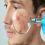 Skinduced